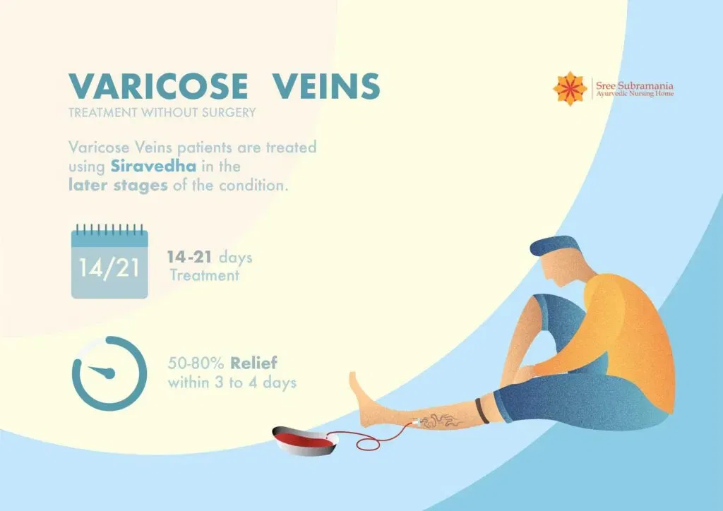 Effectiveness of siravedha as a varicose veins treament option