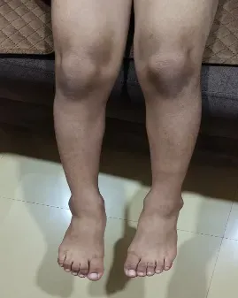 After Treatment Image