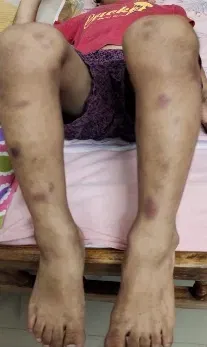 Before Treatment Image