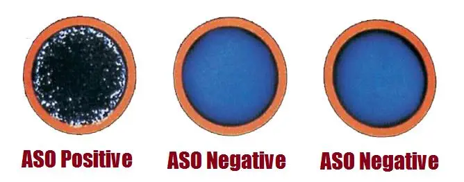Understanding ASO Case details for the treatment of rheumatoid arthritis