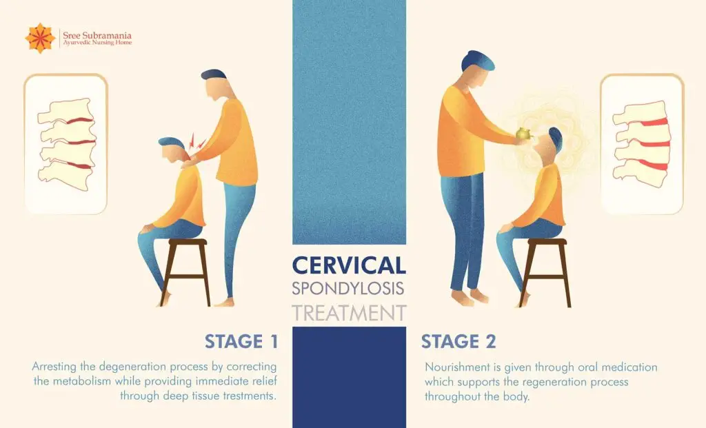 stagewise-treatment-of-cervical-spondylosis-ayurveda Effect of ayurvedic treatment for cervical spondylosis split in two stages